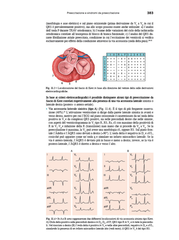 Le Aritmie Cardiache - Meccanismi, diagnosi e terapia