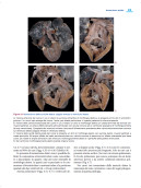 Cardiopatie congenite. Testo Atlante