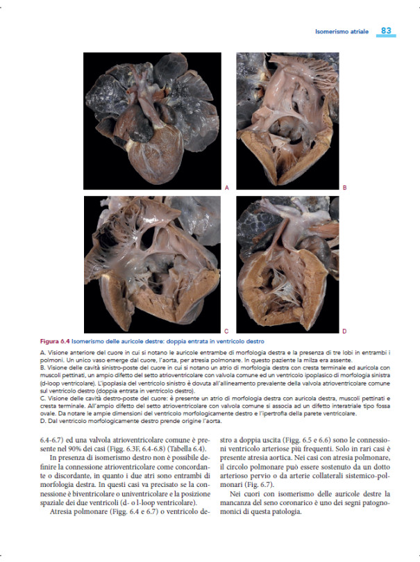 Cardiopatie congenite. Testo Atlante