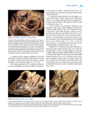 Cardiopatie congenite. Testo Atlante