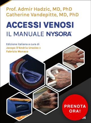 Accessi venosi – Il manuale Nysora©