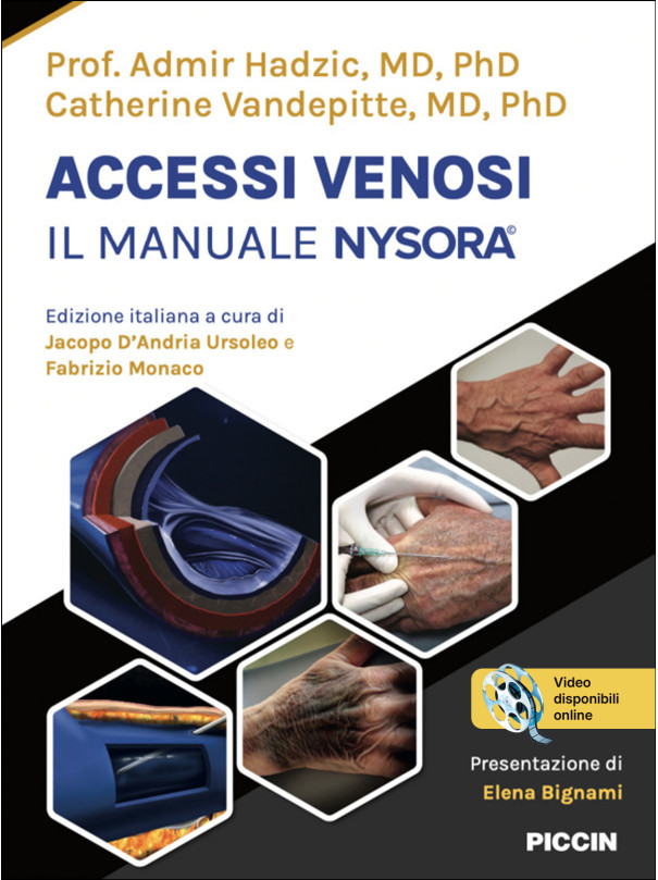 Accessi venosi – Il manuale Nysora©