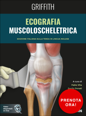 Ecografia muscoloscheletrica