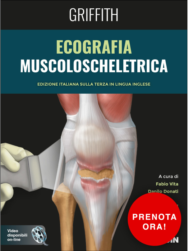 Ecografia muscoloscheletrica