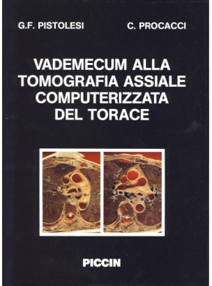 Vademecum alla tomografia assiale computerizzata del torace