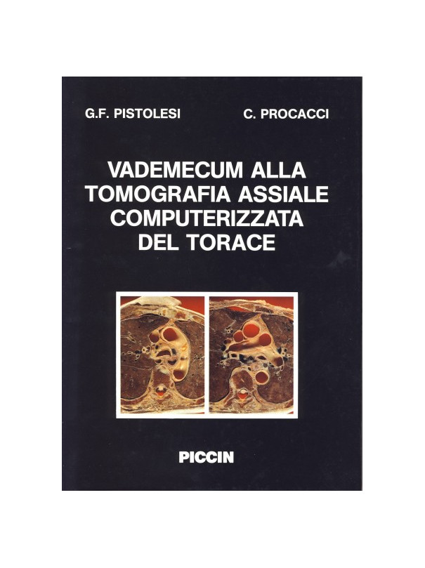 Vademecum alla tomografia assiale computerizzata del torace