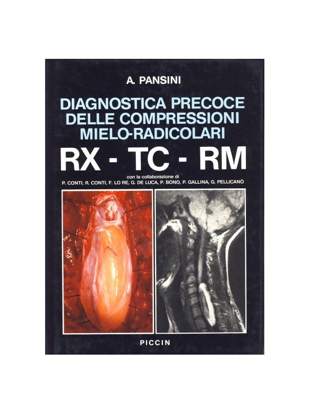 Diagnostica precoce delle compressioni mielo-radicolari RX-TC-RM
