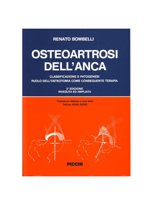 Osteoartrosi dell'anca