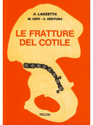 Fratture del cotile