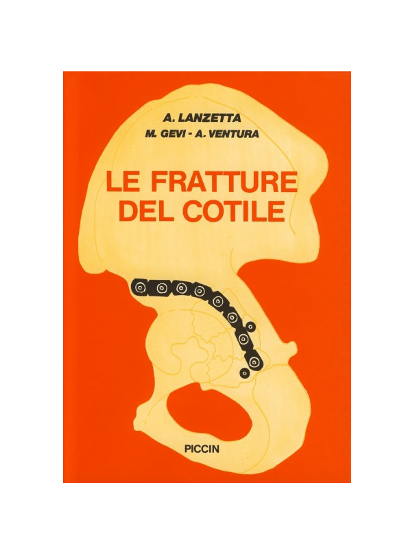 Fratture del cotile