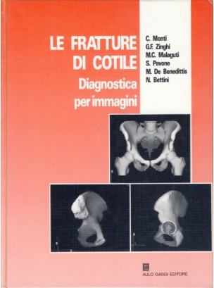 Le fratture di cotile. Diagnostica per immagini