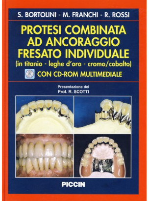 Protesi Combinata ad Ancoraggio Fresato Individuale