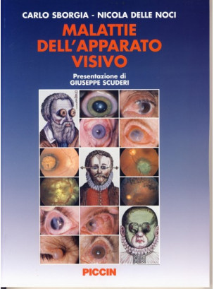 Malattie dell'Apparato Visivo