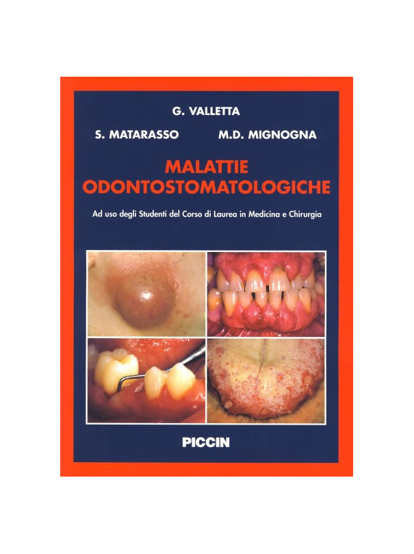 Malattie Odontostomatologiche